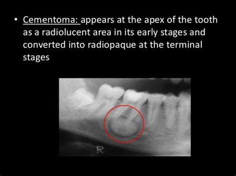 Radiographic Interpretation