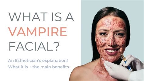 What Is A Vampire Facial Main Benefits And How It Works Youtube