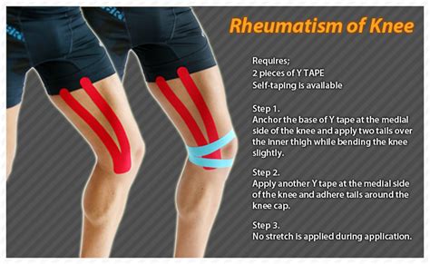 Kinesiology Taping Instructions For Rheumatism Of The Knee Ktape Ares