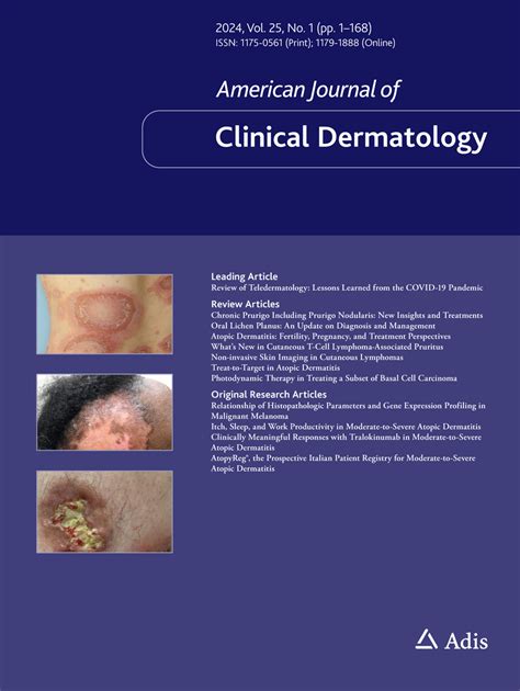 Dupilumab A Review In Moderate To Severe Atopic Dermatitis American