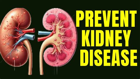 How To Prevent Kidney Disease Naturally 7 Scientific Hacks You Need