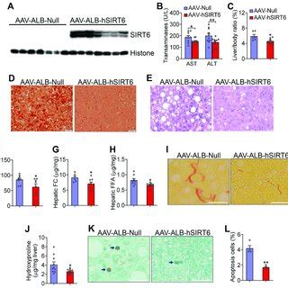 Over Expression Of Hepatic Sirt In Ldlr Mice Protects Against