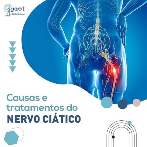 Causas e tratamentos do NERVO CIÁTICO GAOT