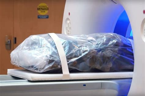 500 Year Old Inuit Mummies Show Atherosclerosis In CT Scans