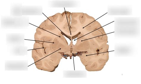 Diagram Of Brain Coronal Section Quizlet