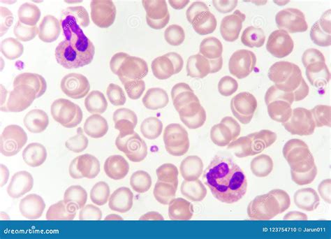 White Blood Cells in Blood Smear Stock Photo - Image of health ...