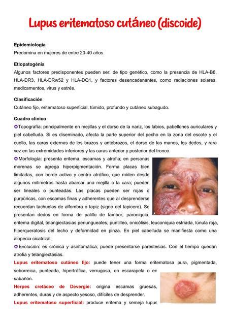 Lupus Eritematoso Cut Neo Apun Tesmedicina Udocz