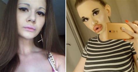 Fotos Mujer Con Los Labios M S Grandes Del Mundo Quiere Parecerse A