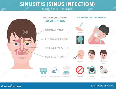 Nasal Diseases. Sinusitis, Sinus Infection Diagnosis and Treatment ...