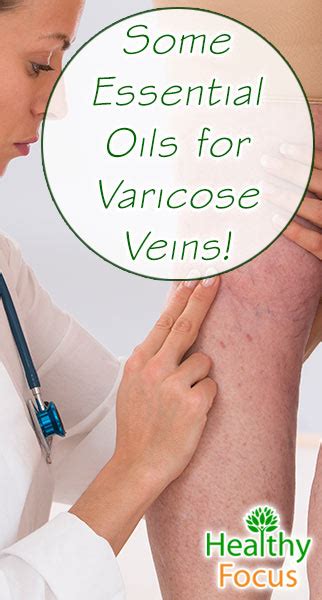 9 Proven Essential Oils For Varicose Veins Healthy Focus