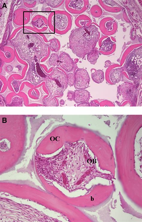 Histological Analysis Of Implants Hematoxylineosin Stained Sections Of