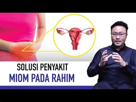 Ciri Miom Membesar Penyebab Gejala Dan Pengobatan Ciri Or Id