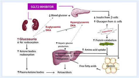 Schematic Illustration Of The Pathophysiology Of Perioperative Diabetic