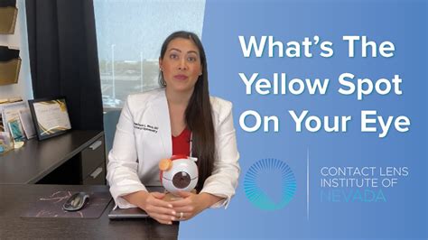 What To Do If You Have A Yellow Spot On Your Eye Youtube