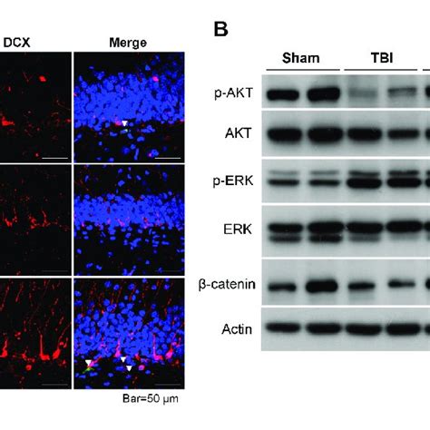 CES upregulates PI 3 kinase Akt MEK ERK and Wnt β catenin signaling