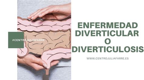 Tratamiento De La Diverticulitis