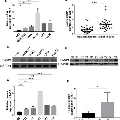 The MRNA And Protein Expression Of TASP1 In HCC Cell Lines HCC Tissues