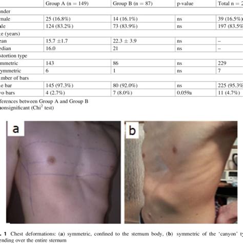 PDF Surgical Correction Of Pectus Excavatum By The Nuss Procedure A