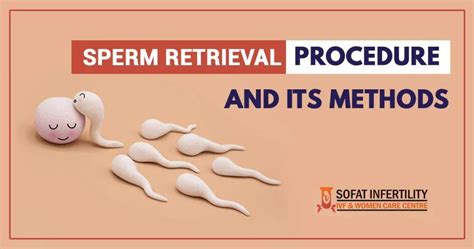 Everything You Need To Know About Sperm Retrieval Procedure And Its