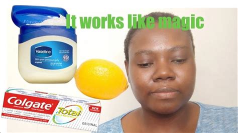 Lemon On Face Honey Face Vaseline For Face Clear Skin Naturally