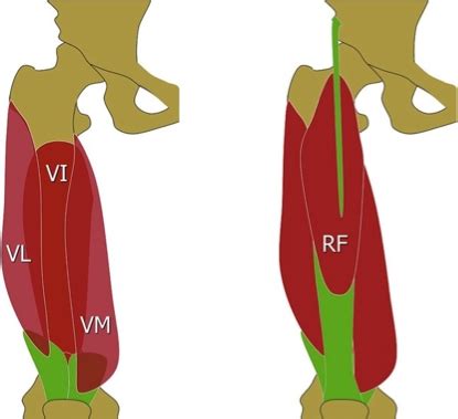 Sports Injury Bulletin Diagnose Treat Quadriceps Strains And