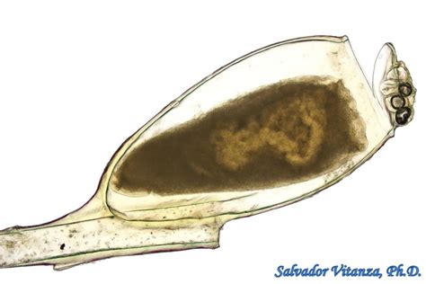 Psocodea Pediculidae Pediculus Humanus Capitis Head Louse EGG Or NIT A