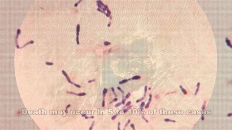 Corynebacterium Diphtheriae Simple Stain