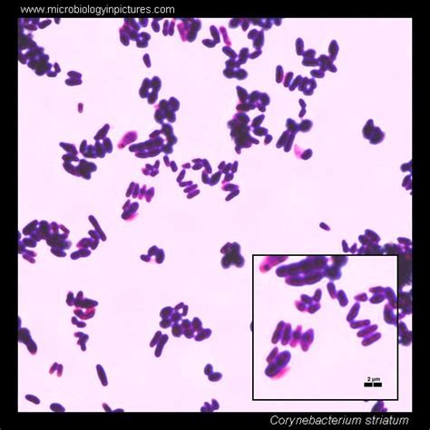 Palisades Bacteria