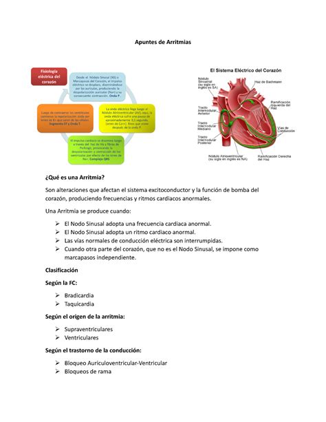 Apuntes De Arritmias Apuntes De Arritmias Qu Es Una Arritmia Son
