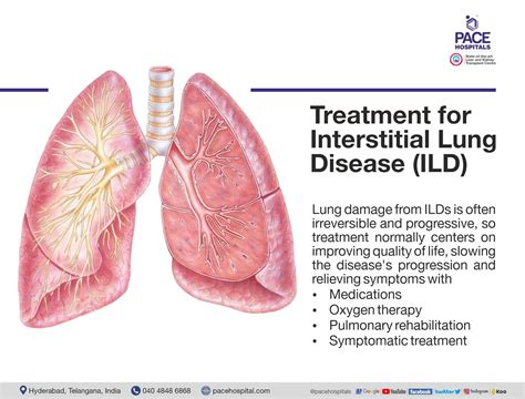 Interstitial Lung Disease Causes Symptoms And Treatment