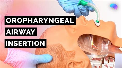 Oropharyngeal Airway And Nasopharyngeal Airway