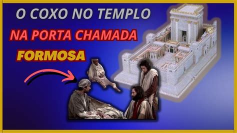 A Cura Do Coxo Que Ficava Na Porta Do Templo Chamada Formosa YouTube