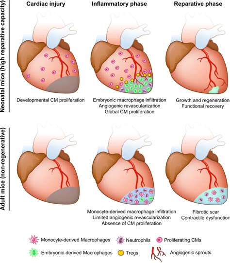 Immune Responses In Cardiac Repair And Regeneration A Comparative