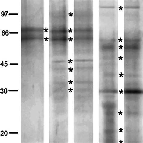 Gelatin Containing Sds Page Gels Showing The Effect Of Protease