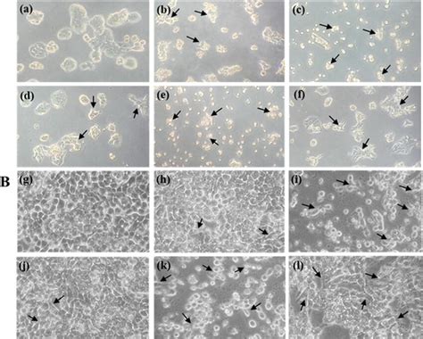 Effect Of Vanillin Extracted From PM And BM On Morphological Changes In