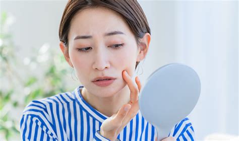 ほうれい線を消す方法は？今すぐできるセルフケアを皮膚科医が解説 ｜ からだにいいこと