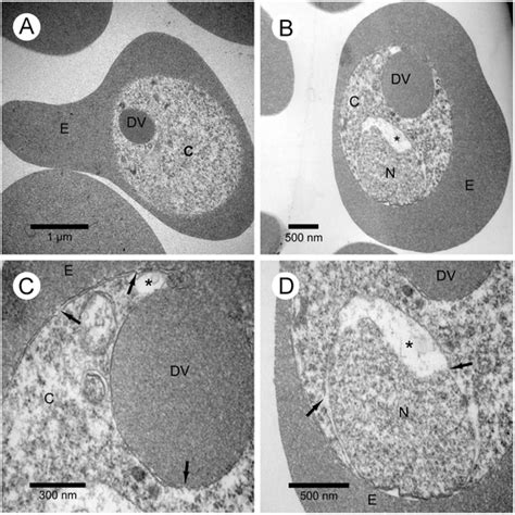 Shows The First Parasitic Stage Of Pyy That Corresponds To The Ring