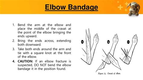 Bandaging Triangular Bandaging And Cravat Types Of Knots