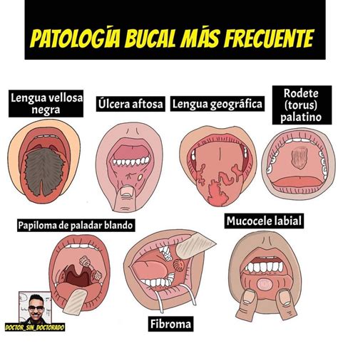 Pin De Nathi Leite En Odontologia Escuela De Higiene Dental