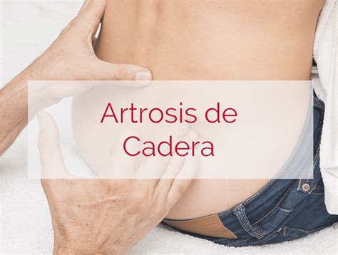 Artrosis De Cadera S Ntomas Causas Y Tratamientos Orthokine