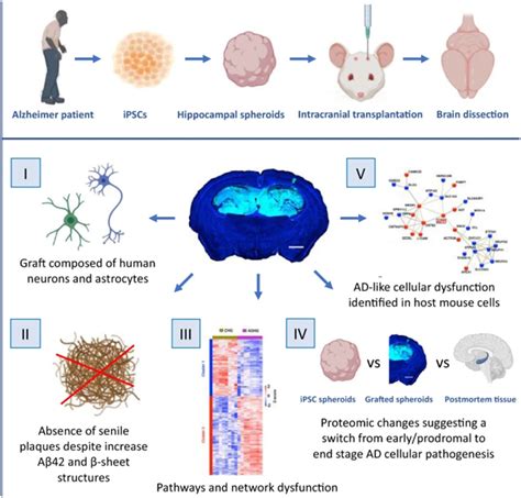 Acta Neuropathol Com：利用源自阿尔茨海默病患者的诱导性多能干细胞构建新的疾病模型，有助更好理解这种疾病如何在大脑中进展