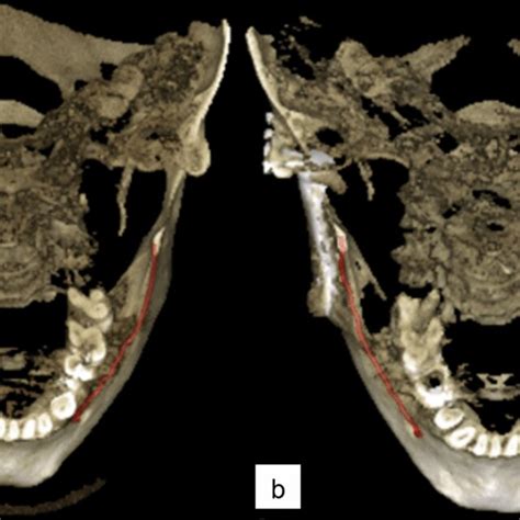 Three Dimensional Reconstruction Images With Manually Annotated