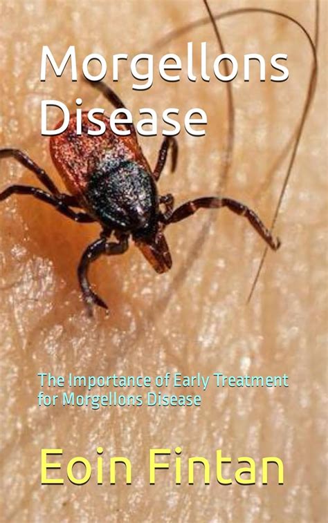 Morgellons Disease The Importance Of Early Treatment For Morgellons