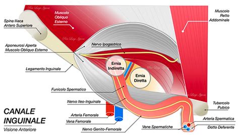 Chirurgia Open Ernia Inguinale Ernia Center Firenze