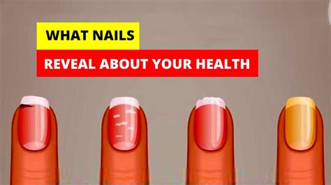 What Your Nails Reveal About Your Health Youtube