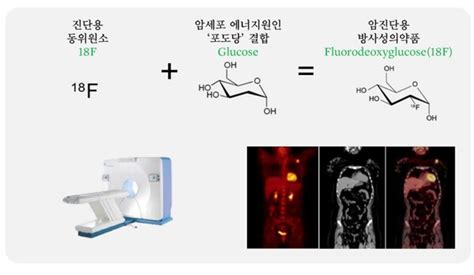 듀켐바이오 방사성의약품이 암 말고도 뇌종양 치매까지 진단한다고 Pr