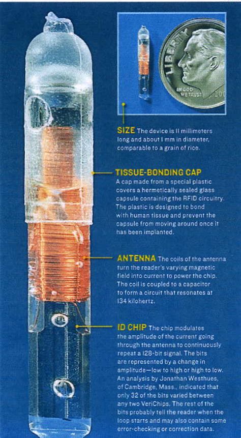 Microchip Humans RFID