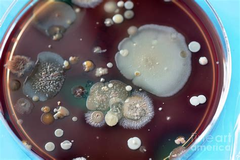 Bacterial Colonies In Petri Dish Photograph By Wladimir Bulgarscience