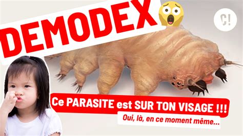 Vid O Demodex Cet Acarien Qui Vit Sur Votre Visage Curieux