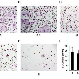 Myeloma Increased Gr 1 CD11b Cells In Mice A B Flow Cytometry